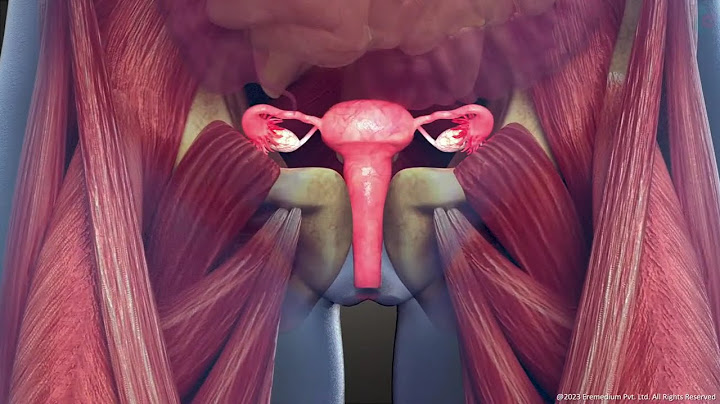 Uterine intramural leiomyoma