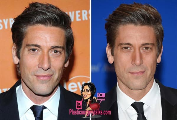 What happened to david muir's face