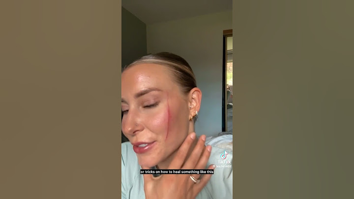 Facial scar