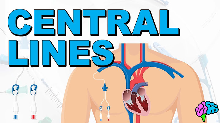 Central line theory