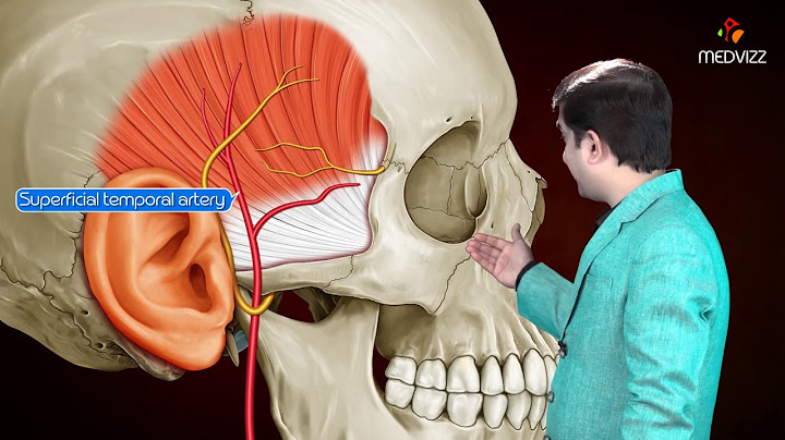 Temporal area head