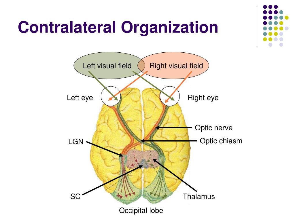 Contralateral organization