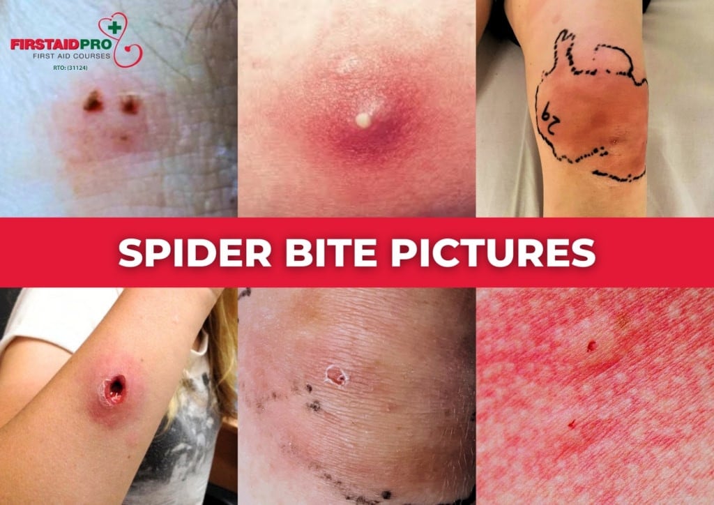 How does spider bite look like