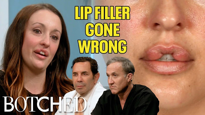 Lip surgery gone bad