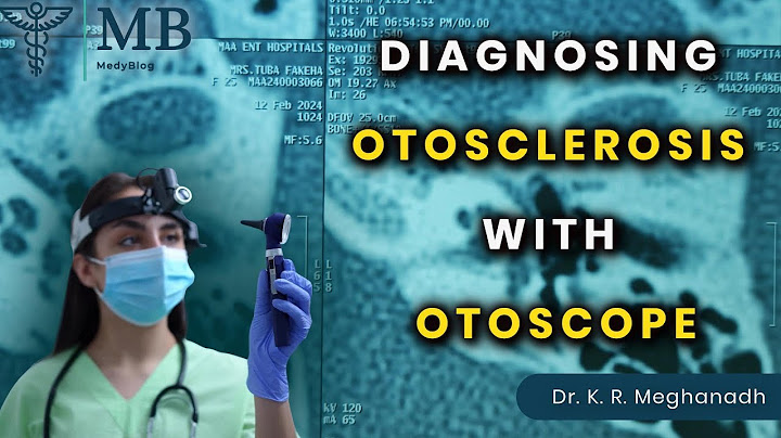 Otoscopy otosclerosis