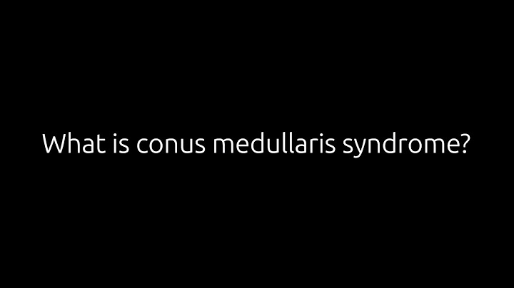What is the conus