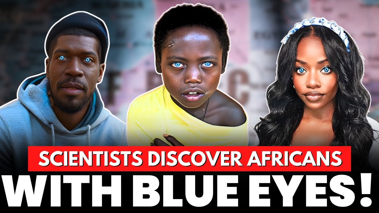 Can african americans have blue eyes