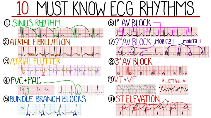 Practical ekg