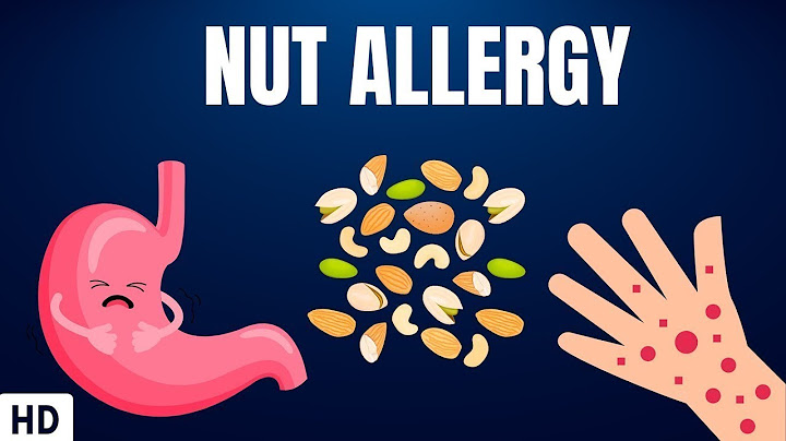 Not allergy
