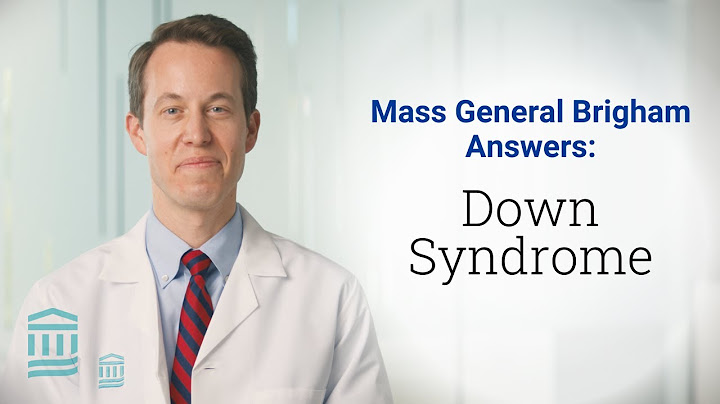 Down syndrome sign